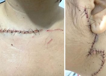 Garoto de 14 anos que tentou matar a mãe tem histórico de agressões contra ela, aponta namorado da vítima